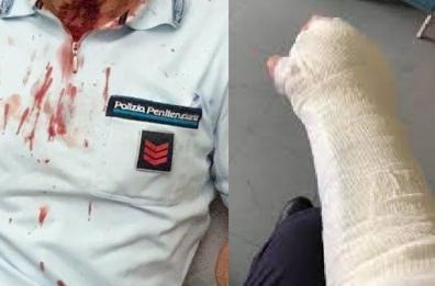 Taranto, «disturbato» dai colpi alla finestra alle 8 del mattino, detenuto aggredisce agente penitenziario e lo manda in ospedale