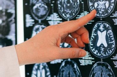 Castrignano del Capo, il deterioramento cognitivo tra fragilità e prevenzione: oggi il convegno
