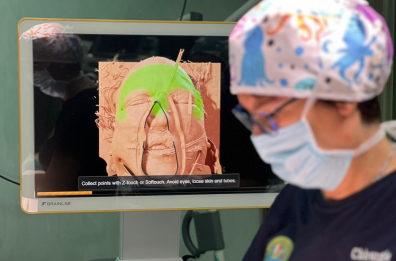 Bari, al Policlinico la tecnologia 3D per ricostruire chirurgicamente il volto dopo gravi traumi