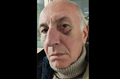 Bitonto, la denuncia di un dipendente Asl: «Un medico mi ha colpito con un pugno. E poi parlano di violenze in corsia» Bitonto, la denuncia di un dipendente Asl: «Un medico mi ha colpito con un pugno. E poi parlano di violenze in corsia»