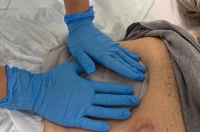 Al centro &laquo;Stoma care&raquo; della Asl di Bari 2.500 accessi nel 2025