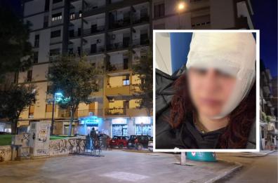 Bari, identificato e denunciato l'uomo che ha aggredito la 24enne a martellate: &egrave; un barese 61enne