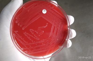 Andria, uomo morto dopo aver mangiato carne cruda: indagini su possibile contaminazione da listeria. Nel mirino una macelleria