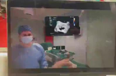 A Bari la realtà aumentata in sala operatoria: intervento di cardiochirurgia endoscopica con visore
