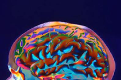 Sepsi ovvero infezione diffusa