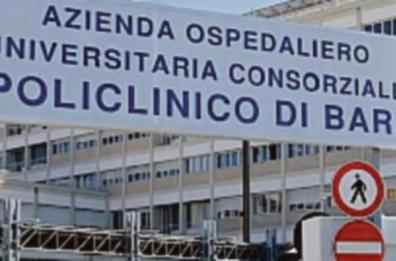 «Cataratta a pagamento, numeri fuori controllo»: l'Agenas smentisce il Policlinico di Bari