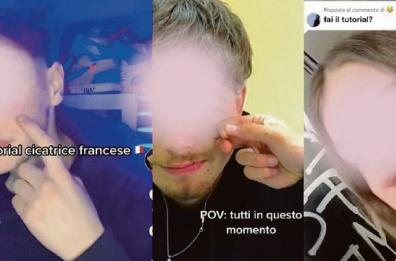 «Cicatrice francese» TikTok nel mirino, parla Balzano: «È la risposta a un disagio»