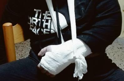 Disabile deriso e pestato dal «branco» a Conversano: ha un braccio fratturato