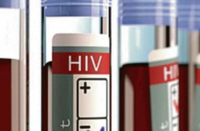 Bari, domani e giovedì test gratuiti contro l’Hiv e le epatiti
