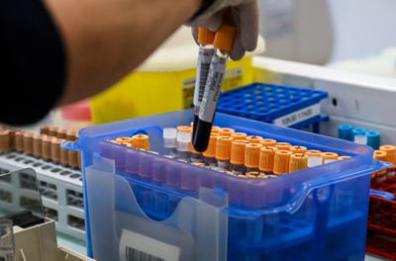 Fegato, un test per scoprire il rischio di gravi malattie entro 10 anni: lo studio