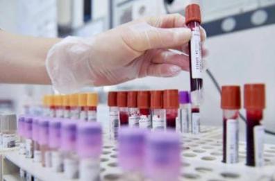 Fondazione Airc, 142 mln in ricerca per 779 progetti nel 2026