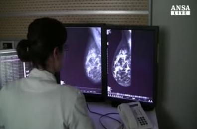 Puglia, tumore seno in 10 donne
 che lavorano di notte in  ospedale