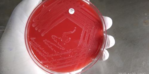 Andria, uomo morto dopo aver mangiato carne cruda: indagini su possibile contaminazione da listeria. Nel mirino una macelleria