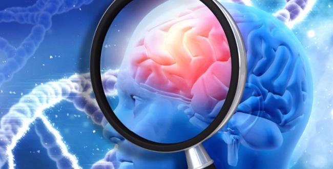 L&rsquo;Alzheimer si pu&ograve; fermare (se diagnosticato in tempo) con un nuovo farmaco studiato anche a Bari