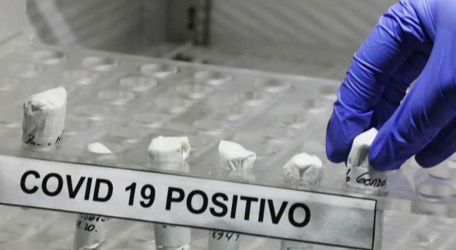 Covid in Puglia, cresce curva contagi (+1581) su 10mila test: 23 i morti. Balzo indice positività al 15,7%
