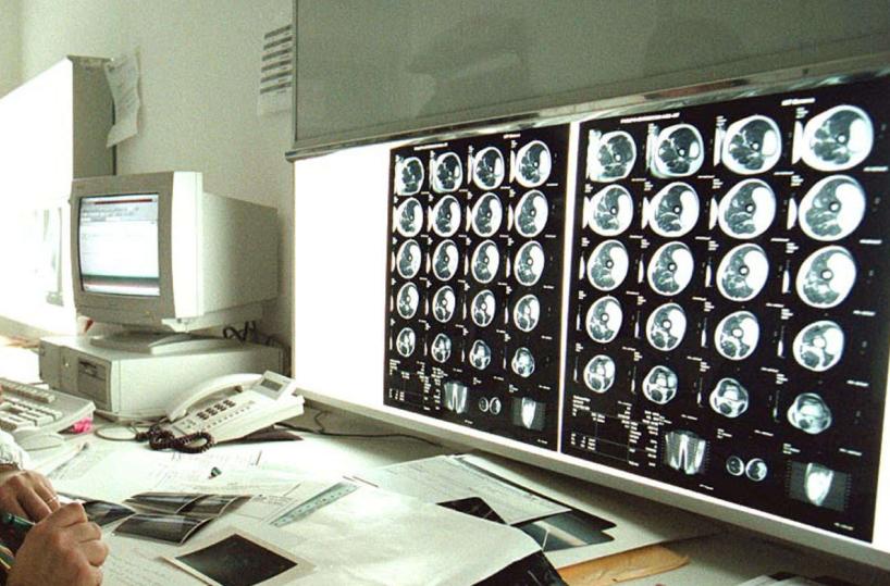 tumori, oncologo