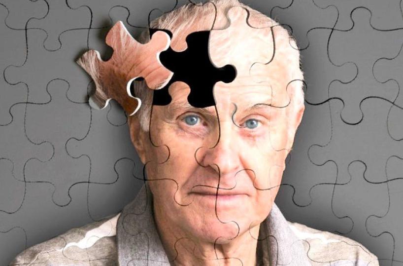 Alzheimer