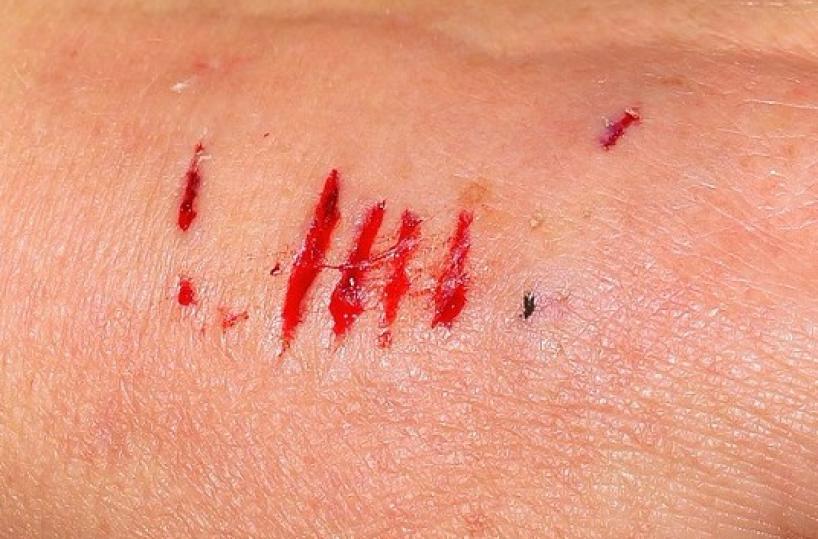 sangue