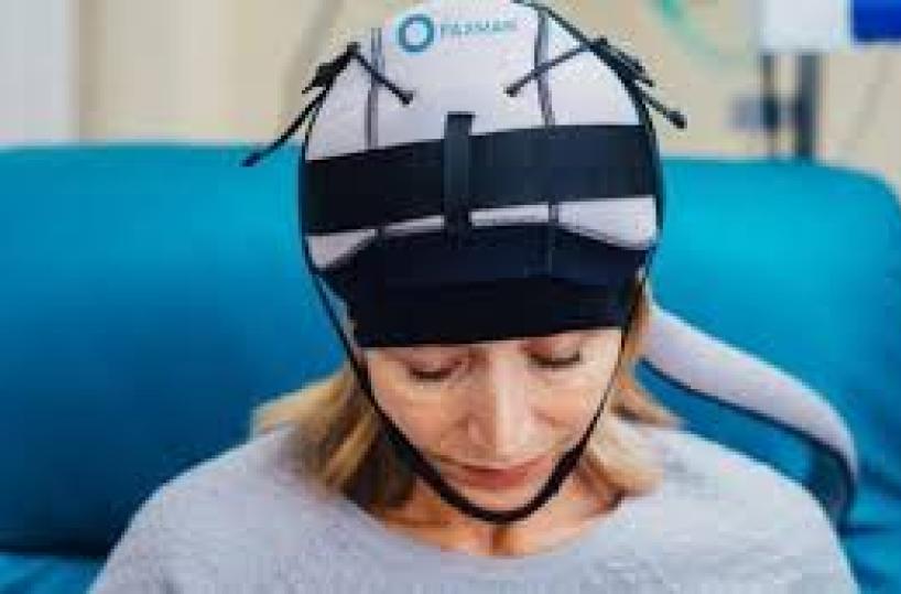 casco alopecia