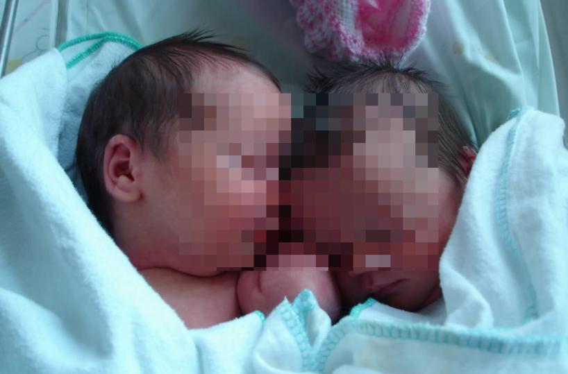 Bari, ecco Andrea e Fabio, gemelli ma nati in due anni diversi
