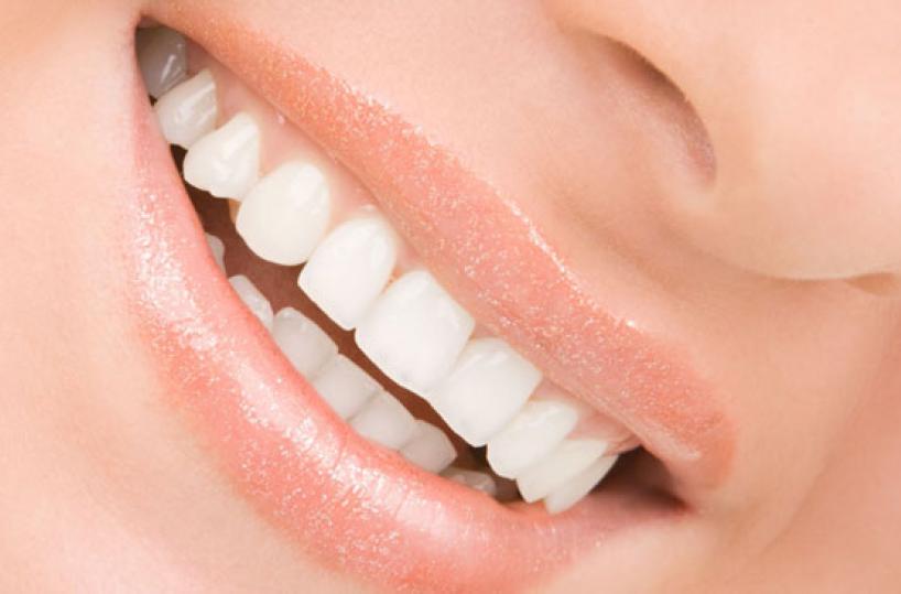 Sorriso, denti