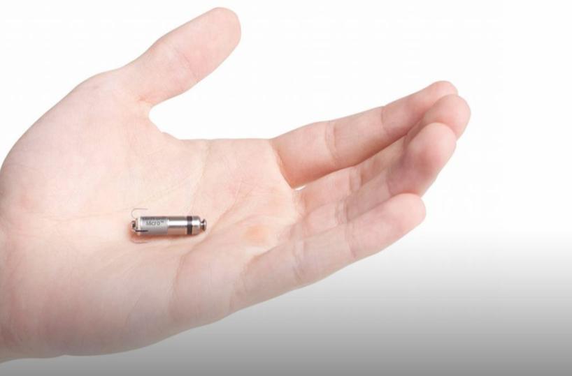Installato a Bari micro pacemaker wireless per incontinenza