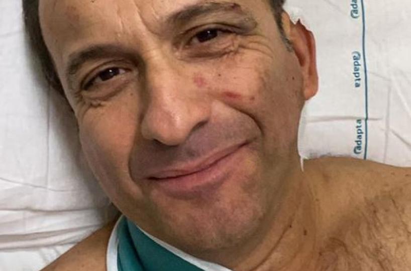 Bari, scontro fra due auto: coinvolto anche il comico Uccio De Santis
