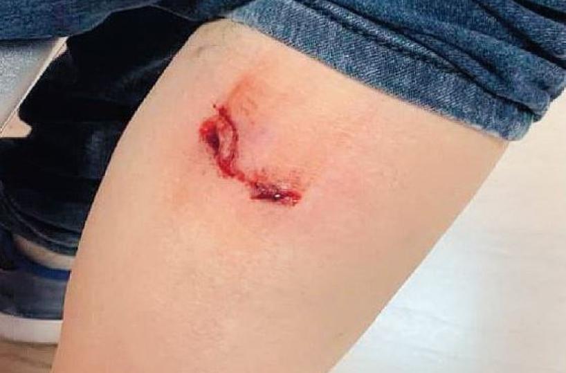 Corato, aggredita da cani randagi: incubo per una signora
