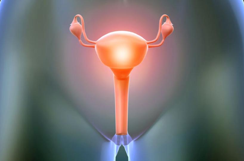 Tumore dell'ovaio neoplasia ancora difficile da trattare