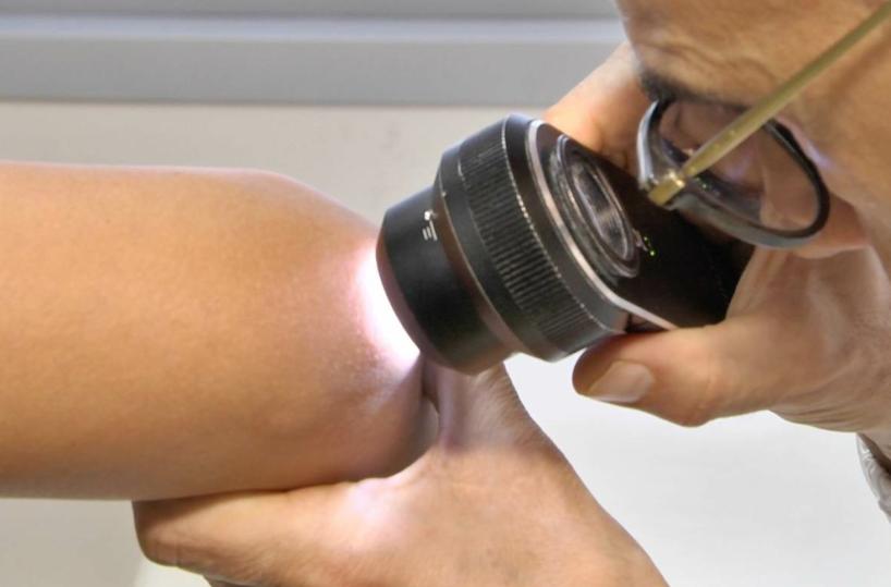 Psoriasi, un corto per superare vergogna, depressione, isolamento e liberare le proprie emozioni