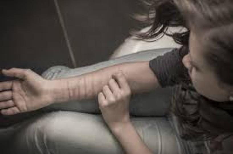 Lecce, allarme Cutting, adolescenti a rischio: «I tagli ci danno sollievo»