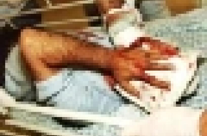 Egitto - Grave incidente stradale, feriti due turisti italiani