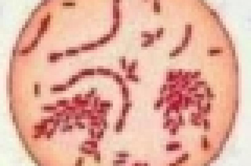 Grave studentessa per meningite ma la sua scuola di Bari non chiude