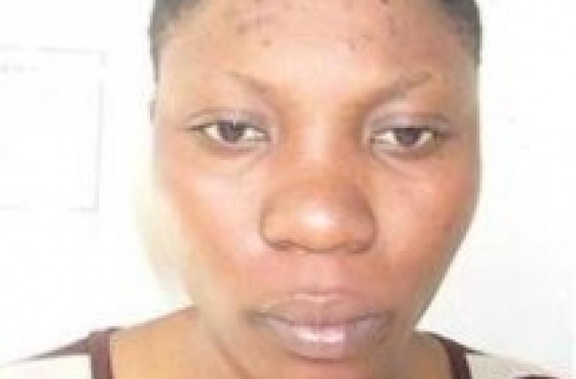 Bari, prostituta nigeriana muore di Tbc «Chi è stato con lei faccia subito il test»