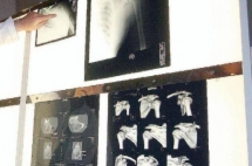 Inchieste sanità Puglia, rubati da Asl computer con fatture protesi