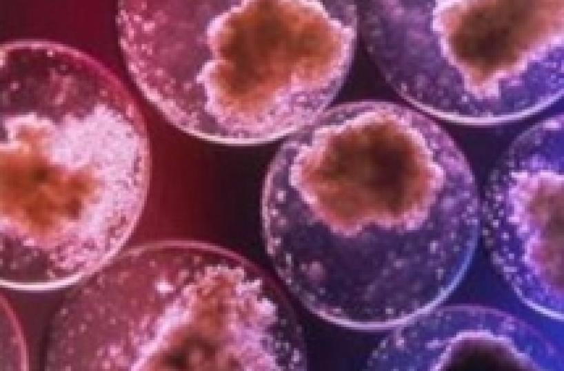 Sla, pronta la fase 2: trapianti sicuri con le cellule staminali
