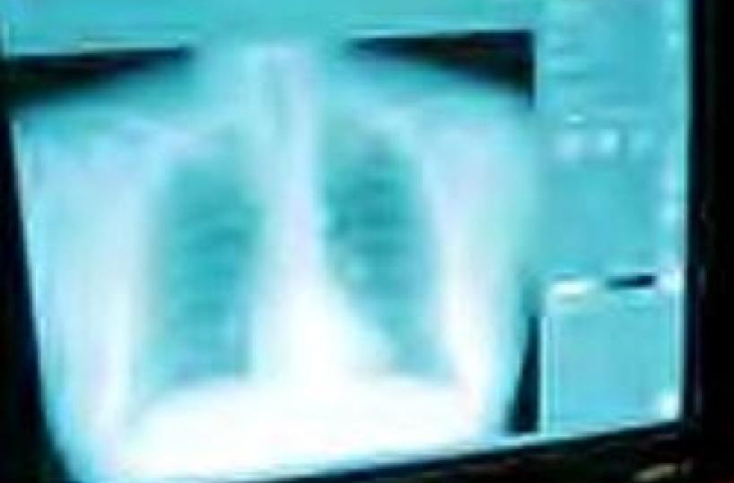 Iniziative per combattere malattie respiratorie