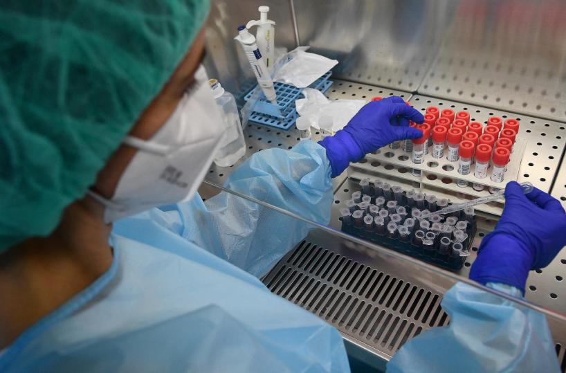 Covid, ecco il nuovo test affidabile e rapido ideato da tre donne baresi