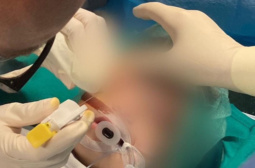Paziente suicida al Policlinico di Bari, indagati medici e direttore generale