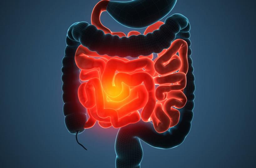 Malattie funzionali gastrointestinali: pubblicato lo studio