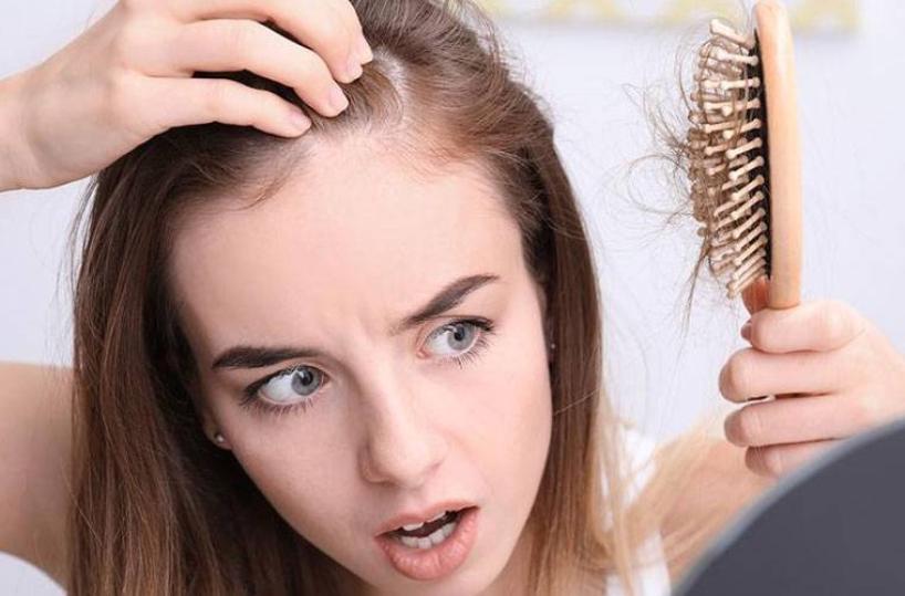 Alopecia, un problema che affligge 4 milioni di donne