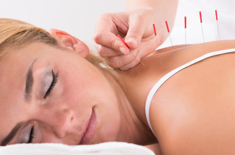 Agopuntura, da 6mila anni una metodica di diagnosi e cura efficace