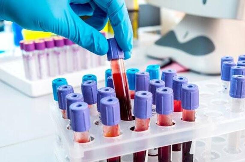 Puglia, stop analisi in esenzione nei laboratori privati