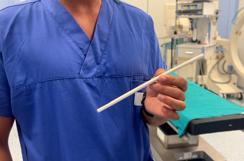 Bari, al Policlinico si sperimenta una protesi riassorbibile per i pazienti sottoposti a emodialisi