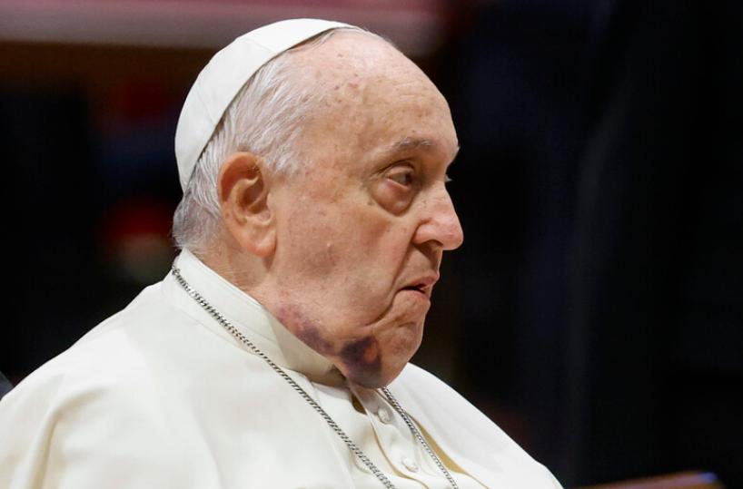 Papa Francesco ha ancora la bronchite: il pontefice ricoverato al Gemelli di Roma