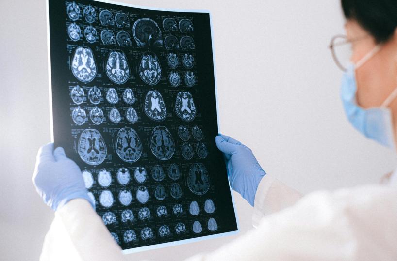 Un radiotracciante per l'analisi precoce di Alzheimer e Parkinson: lo studio pugliese passa alla fase 2
