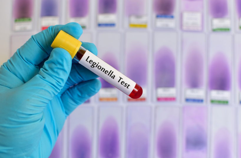Legionella, al via la campagna di prevenzione della ASL Bari per RSA, alberghi e B&B