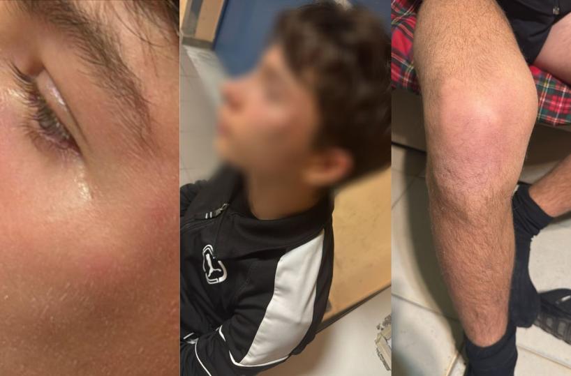 Calcio, arbitro 15enne aggredito durante partita Under 16 tra Ginosa e Laterza: l’AIA denuncia episodio di violenza