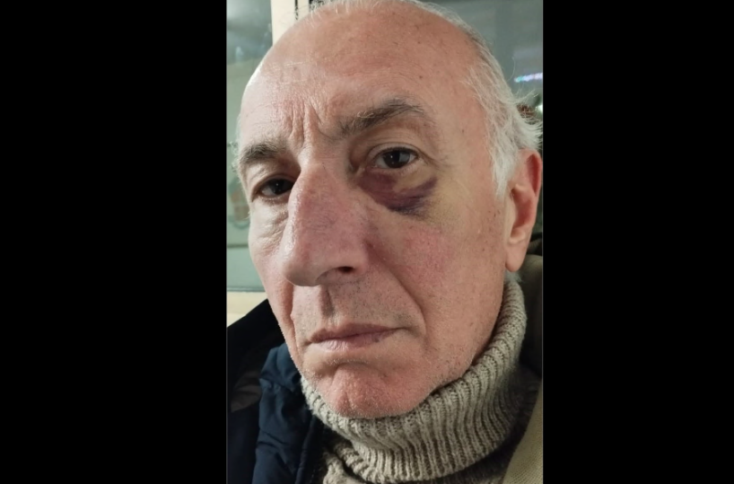 Bitonto, la denuncia: «un medico mi ha colpito con un pugno e poi parlano di violenze in corsia»