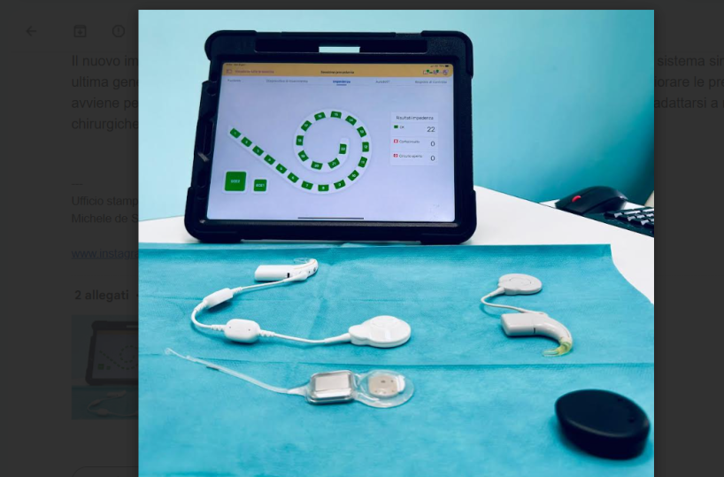 Policlinico di Bari, restituito l'udito a un bambino di 11 anni grazie al primo impianto cocleare smart 